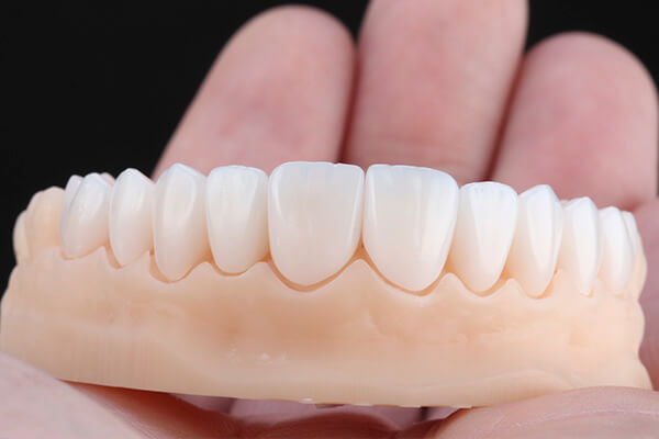 Leia mais sobre o artigo Qual a melhor clínica para colocação de Facetas de Porcelana em Chapecó?