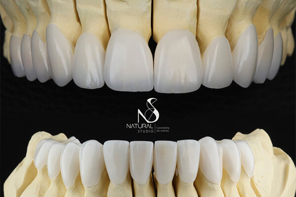 Leia mais sobre o artigo Saiba dos benefícios da Reabilitação Oral