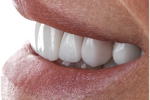 Leia mais sobre o artigo Plástica Gengival