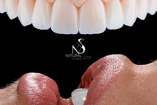 Leia mais sobre o artigo 8 Dicas importantes sobre Facetas de Porcelana